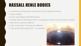 HASSALL HENLE BODIES
• excrescences of Descemet’s membrane found in peripheral cornea
• Aging changes
• Due to age related endothelial cell loss
• Nodular areas of thickening of DM in the periphery extend into the anterior chamber
• Best seen on specular reflection
• Dark, round holes in the specular reflection
• They are clinically insignificant – no treatment
 