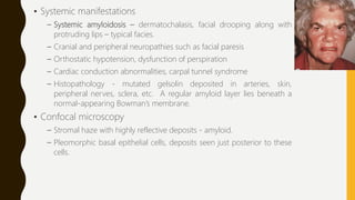 • Systemic manifestations
– Systemic amyloidosis – dermatochalasis, facial drooping along with
protruding lips – typical facies.
– Cranial and peripheral neuropathies such as facial paresis
– Orthostatic hypotension, dysfunction of perspiration
– Cardiac conduction abnormalities, carpal tunnel syndrome
– Histopathology - mutated gelsolin deposited in arteries, skin,
peripheral nerves, sclera, etc. A regular amyloid layer lies beneath a
normal-appearing Bowman’s membrane.
• Confocal microscopy
– Stromal haze with highly reflective deposits - amyloid.
– Pleomorphic basal epithelial cells, deposits seen just posterior to these
cells.
 
