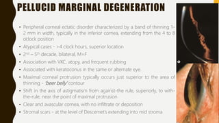 PELLUCID MARGINAL DEGENERATION
• Peripheral corneal ectatic disorder characterized by a band of thinning 1–
2 mm in width, typically in the inferior cornea, extending from the 4 to 8
o’clock position
• Atypical cases - >4 clock hours, superior location
• 2nd – 5th decade, bilateral, M=F
• Association with VKC, atopy, and frequent rubbing
• Associated with keratoconus in the same or alternate eye.
• Maximal corneal protrusion typically occurs just superior to the area of
thinning - ‘beer belly’ contour
• Shift in the axis of astigmatism from against-the rule, superiorly, to with-
the-rule, near the point of maximal protrusion
• Clear and avascular cornea, with no infiltrate or deposition
• Stromal scars - at the level of Descemet’s extending into mid stroma
 