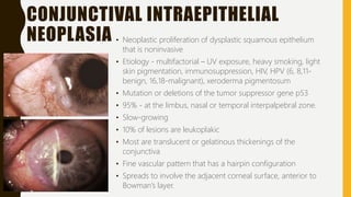 CONJUNCTIVAL INTRAEPITHELIAL
NEOPLASIA • Neoplastic proliferation of dysplastic squamous epithelium
that is noninvasive
• Etiology - multifactorial – UV exposure, heavy smoking, light
skin pigmentation, immunosuppression, HIV, HPV (6, 8,11-
benign, 16,18-malignant), xeroderma pigmentosum
• Mutation or deletions of the tumor suppressor gene p53
• 95% - at the limbus, nasal or temporal interpalpebral zone.
• Slow-growing
• 10% of lesions are leukoplakic
• Most are translucent or gelatinous thickenings of the
conjunctiva
• Fine vascular pattern that has a hairpin configuration
• Spreads to involve the adjacent corneal surface, anterior to
Bowman’s layer.
 