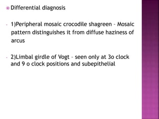  Differential diagnosis
- 1)Peripheral mosaic crocodile shagreen – Mosaic
pattern distinguishes it from diffuse haziness of
arcus
- 2)Limbal girdle of Vogt – seen only at 3o clock
and 9 o clock positions and subepithelial
 