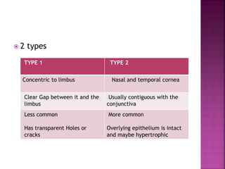  2 types
TYPE 1 TYPE 2
Concentric to limbus Nasal and temporal cornea
Clear Gap between it and the
limbus
Usually contiguous with the
conjunctiva
Less common
Has transparent Holes or
cracks
More common
Overlying epithelium is intact
and maybe hypertrophic
 