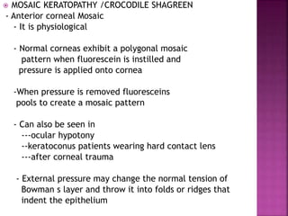  MOSAIC KERATOPATHY /CROCODILE SHAGREEN
- Anterior corneal Mosaic
- It is physiological
- Normal corneas exhibit a polygonal mosaic
pattern when fluorescein is instilled and
pressure is applied onto cornea
-When pressure is removed fluoresceins
pools to create a mosaic pattern
- Can also be seen in
---ocular hypotony
--keratoconus patients wearing hard contact lens
---after corneal trauma
- External pressure may change the normal tension of
Bowman s layer and throw it into folds or ridges that
indent the epithelium
 