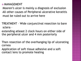  MANAGEMENT
Mooren’s ulcer is mainly a diagnosis of exclusion
All other causes of Peripheral ulcerative keratitis
must be ruled out to arrive here
TREATMENT – Wide conjunctival resection to bare
sclera –
extending atleast 2 clock hours on either side of
the peripheral ulcer and 4 mm posteriorly
Then resection of the overhanging lip of ulcerating
cornea
Application of soft tissue adhesive and a soft
contact lens to promote healing
 