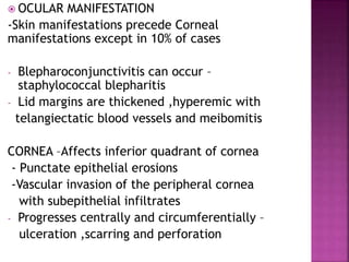  OCULAR MANIFESTATION
-Skin manifestations precede Corneal
manifestations except in 10% of cases
- Blepharoconjunctivitis can occur –
staphylococcal blepharitis
- Lid margins are thickened ,hyperemic with
telangiectatic blood vessels and meibomitis
CORNEA –Affects inferior quadrant of cornea
- Punctate epithelial erosions
-Vascular invasion of the peripheral cornea
with subepithelial infiltrates
- Progresses centrally and circumferentially –
ulceration ,scarring and perforation
 