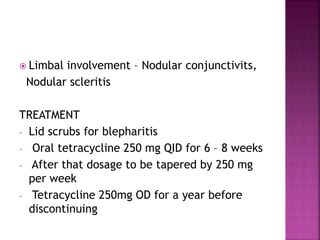  Limbal involvement – Nodular conjunctivits,
Nodular scleritis
TREATMENT
- Lid scrubs for blepharitis
- Oral tetracycline 250 mg QID for 6 – 8 weeks
- After that dosage to be tapered by 250 mg
per week
- Tetracycline 250mg OD for a year before
discontinuing
 