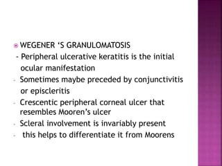  WEGENER ‘S GRANULOMATOSIS
- Peripheral ulcerative keratitis is the initial
ocular manifestation
- Sometimes maybe preceded by conjunctivitis
or episcleritis
- Crescentic peripheral corneal ulcer that
resembles Mooren’s ulcer
- Scleral involvement is invariably present
- this helps to differentiate it from Moorens
 