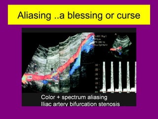 Aliasing ..a blessing or curse
 