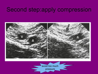 Second step:apply compression
avoid too much
pressure
 