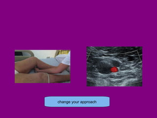 change your approach
 