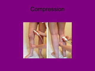 Compression
 