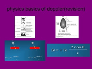 physics basics of doppler(revision)
 