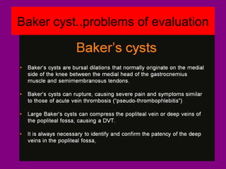 Baker cyst..problems of evaluation
 