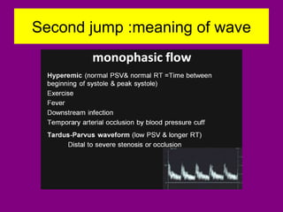 Second jump :meaning of wave
 