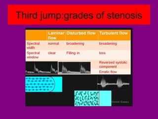 Third jump:grades of stenosis
 