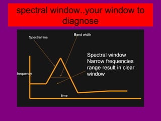 spectral window..your window to
diagnose
 