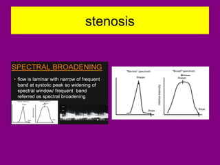 stenosis
 