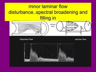minor laminar flow
disturbance..spectral broadening and
filling in
 