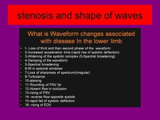 stenosis and shape of waves
 