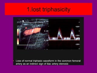 1.lost triphasicity
 