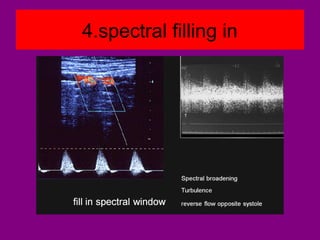 4.spectral filling in
 