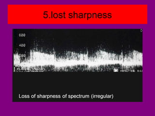 5.lost sharpness
 