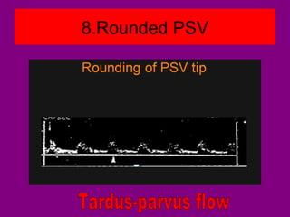 8.Rounded PSV
 