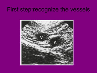 First step:recognize the vessels
 