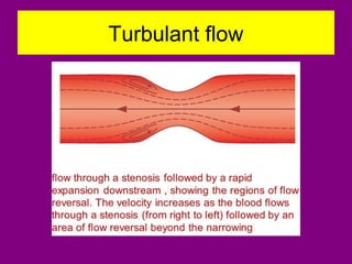 Turbulant flow
 