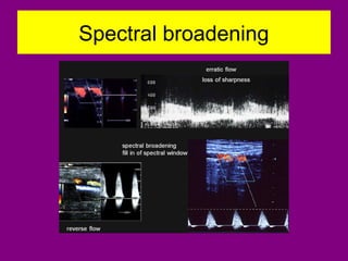 Spectral broadening
 