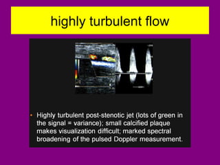 highly turbulent flow
 