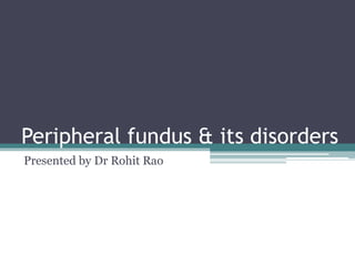 Peripheral fundus & its disorders
Presented by Dr Rohit Rao

 