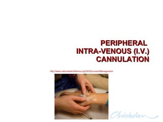 PERIPHERAL  INTRA-VENOUS (I.V.) CANNULATION http://www.nationwidechildrens.org/GD/DocumentManagement 