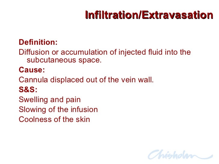 peripheral ivs and phlebitis Maki dgringer m risk factors for infusion-related phlebitis with small peripheral venous catheters peripheral intravenous catheters ivs ltd , schaffhausen. peripheral ivs and phlebitis Maki dgringer m risk factors for infusion-related phlebitis with small peripheral venous catheters peripheral intravenous catheters ivs ltd , schaffhausen.