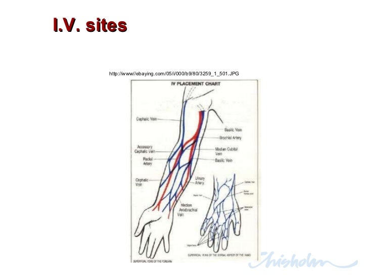 Vein Chart For Iv