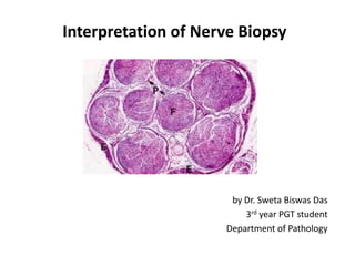 Interpretation of Nerve Biopsy
by Dr. Sweta Biswas Das
3rd year PGT student
Department of Pathology
 