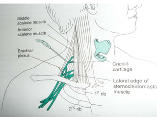 peripheral nerve block DHARMARAJ 123.pdf