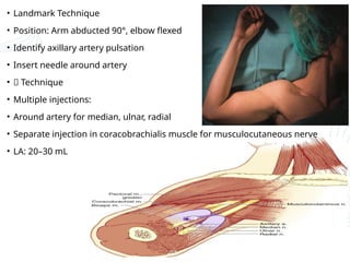 PERIPHERAL NERVE BLOCK IN UPPER LIMB SURGERIES.pptx
