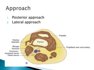 1. Posterior approach
2. Lateral approach
 