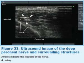 Peripheral nerve blocks