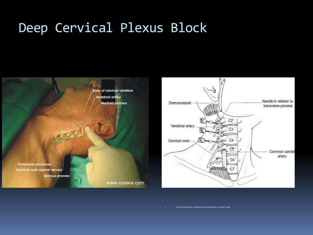Peripheral nerve blocks