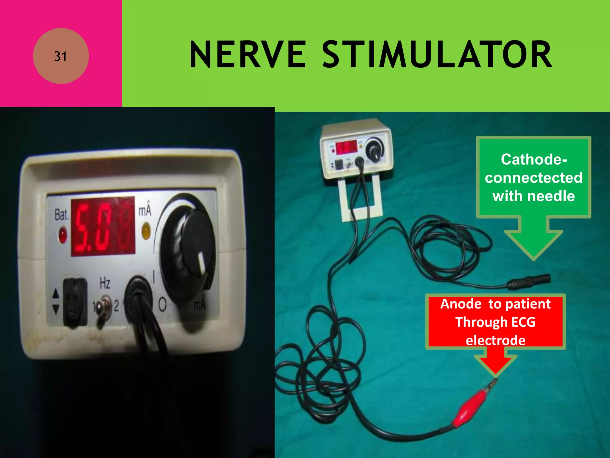 Peripheral nerve blocks 1 by dr.mushtaq | PPTX