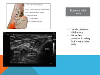 Posterior tibial
nerve
• Locate posterior
tibial artery
• Nerve lies
posterior to artery
(but is very close
to it)
 