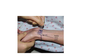 Peripheral Nerve Blocks of the Arm.pptx