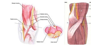 Peripheral Nerve Blocks of the Arm.pptx