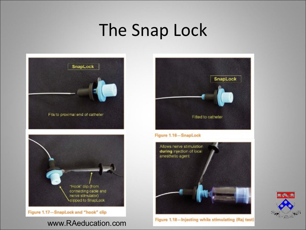 Peripheral Nerve Catheters