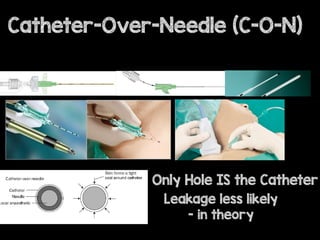 Only Hole IS the Catheter
Leakage less likely
- in theory
Catheter-Over-Needle (C-O-N)
 