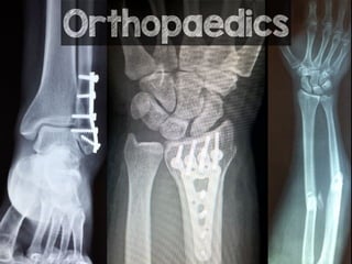 Orthopaedics
 