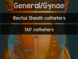 General/Gynae
Rectus Sheath catheters
TAP catheters
 