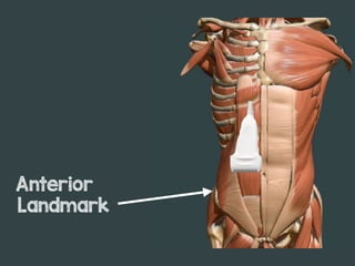 Landmark
Anterior
 